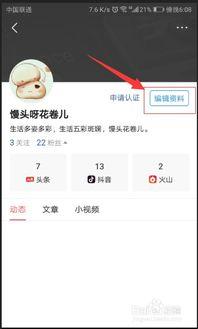 怎么在头条上改昵称,头条昵称修改全攻略