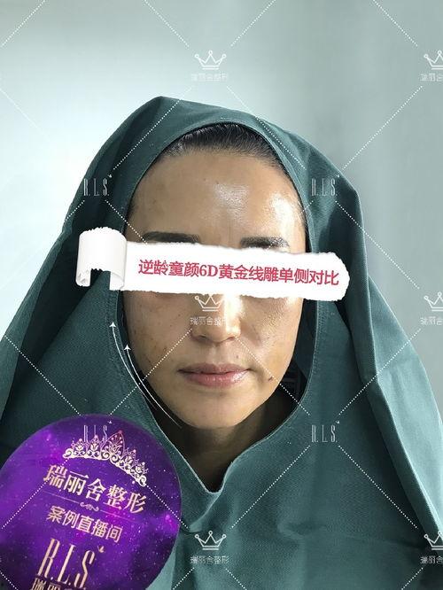 明星的瘦脸面膜,揭秘脸部紧致的秘密武器