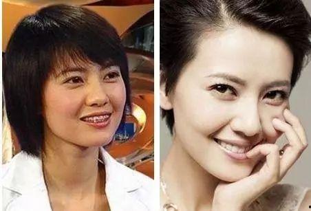 明星都在哪整牙,揭秘明星们变美的秘密武器