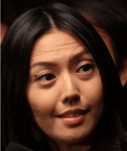 明星打抬头纹吗